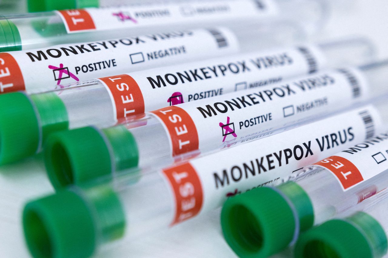 monkeypox-1280x853.jpg